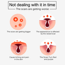 Scar Removal Cream